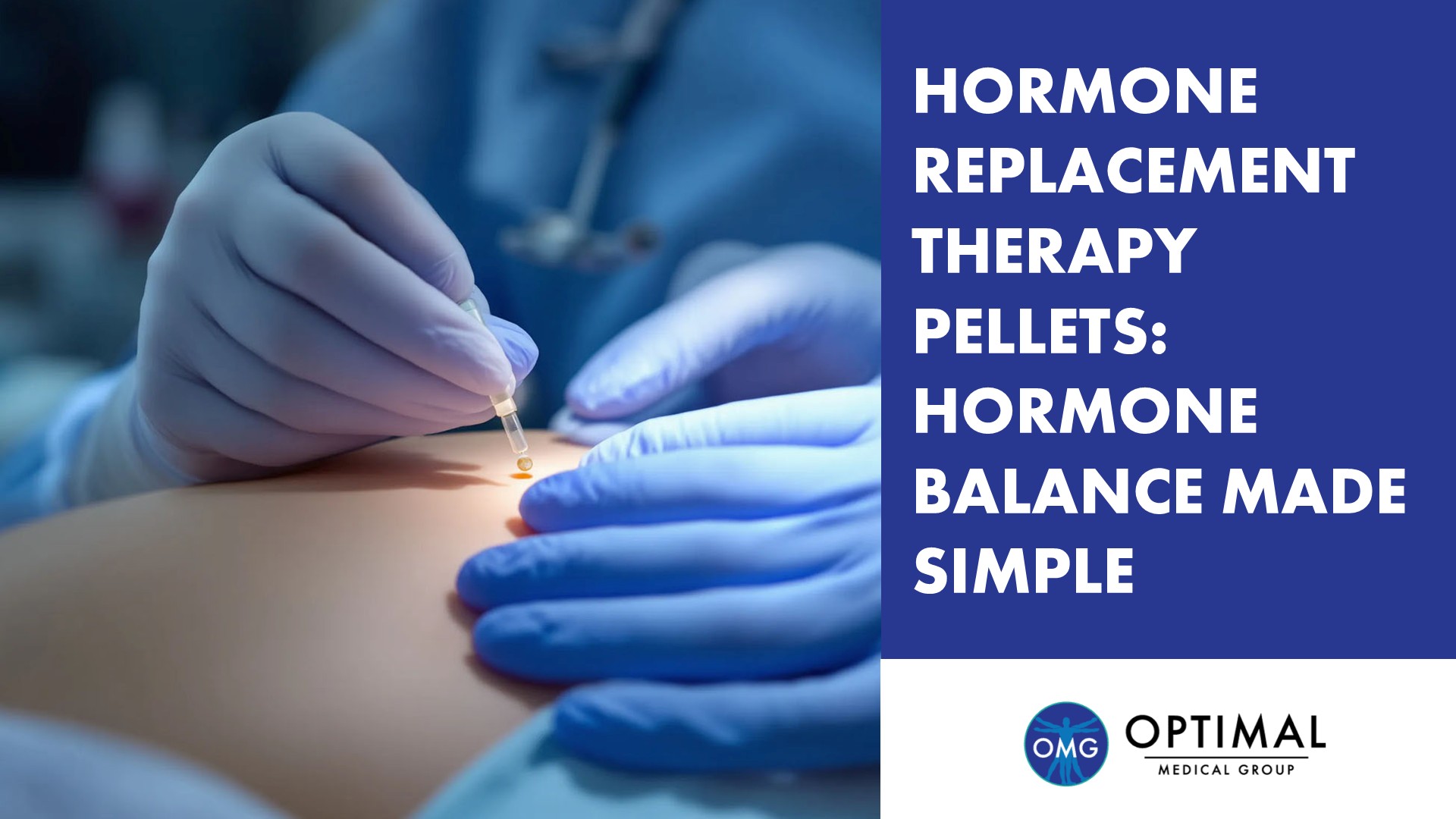 Hormone Replacement Therapy Pellets: Hormone Balance Made Simple By Optimal Medical Group