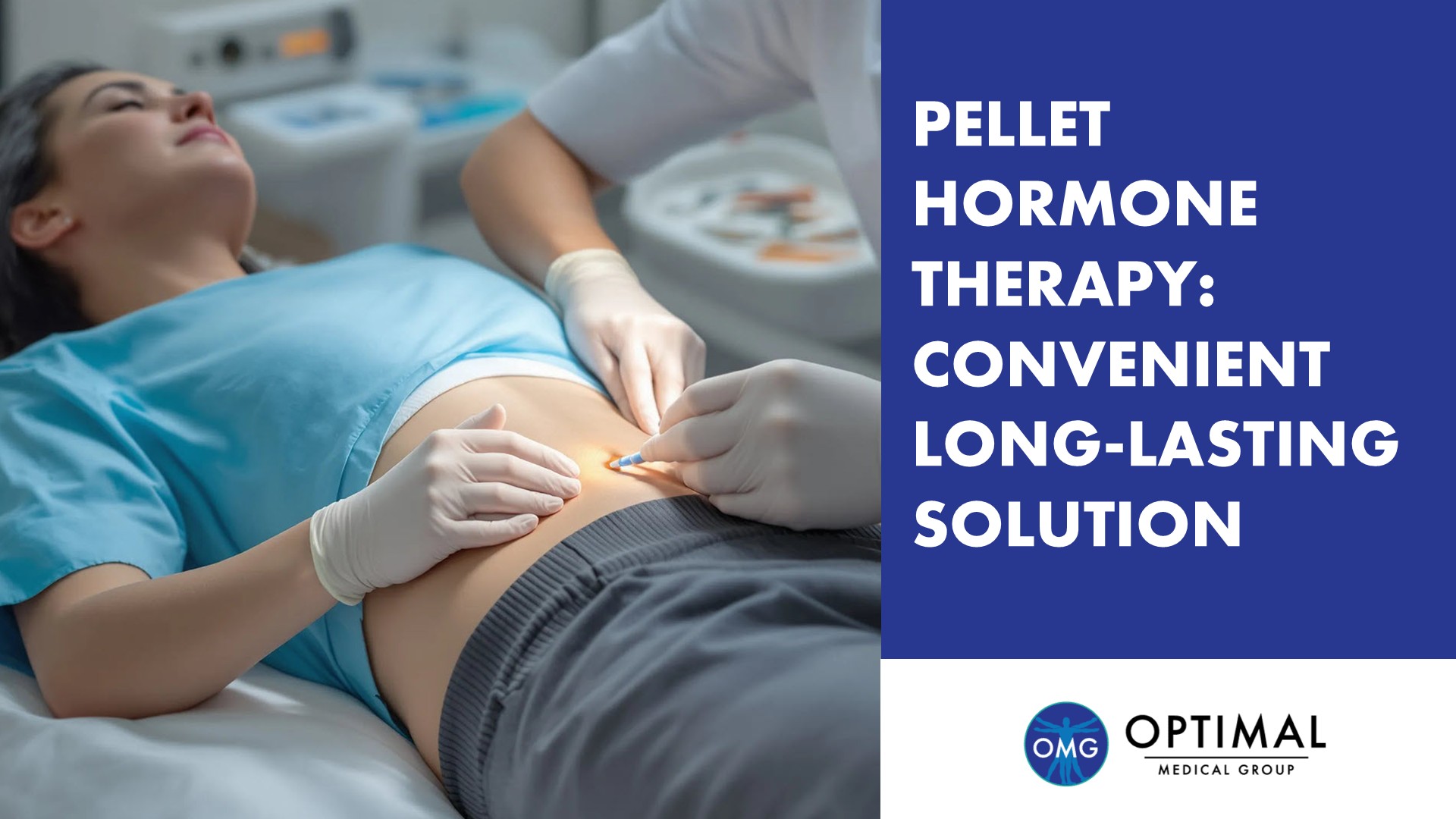 Pellet Hormone Therapy: Convenient Long-Lasting Solution by Optimal Medical Group
